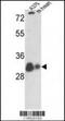 Voltage Dependent Anion Channel 1 antibody, MBS9215285, MyBioSource, Western Blot image 