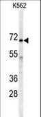 Adenylate Kinase 7 antibody, LS-C99027, Lifespan Biosciences, Western Blot image 