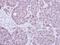 Replication Protein A1 antibody, GTX113003, GeneTex, Immunohistochemistry paraffin image 