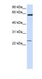 Transmembrane Protein 138 antibody, orb325325, Biorbyt, Western Blot image 