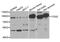 Conserved oligomeric Golgi complex subunit 2 antibody, PA5-76872, Invitrogen Antibodies, Western Blot image 