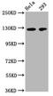 Melanoma Cell Adhesion Molecule antibody, CSB-MA013563A0m, Cusabio, Western Blot image 