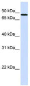 Mitogen-Activated Protein Kinase Kinase Kinase Kinase 2 antibody, TA346724, Origene, Western Blot image 