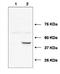 Ubiquitin Conjugating Enzyme E2 J1 antibody, A07059, Boster Biological Technology, Western Blot image 