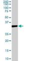 Mesenchyme Homeobox 2 antibody, H00004223-M08, Novus Biologicals, Western Blot image 