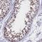 Coiled-Coil Domain Containing 97 antibody, NBP1-91768, Novus Biologicals, Immunohistochemistry frozen image 