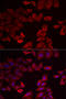 Selenide, water dikinase 1 antibody, 14-972, ProSci, Immunofluorescence image 