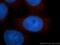 Adhesion Regulating Molecule 1 antibody, 11468-1-AP, Proteintech Group, Immunofluorescence image 