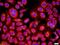 Colony Stimulating Factor 2 Receptor Alpha Subunit antibody, GTX37684, GeneTex, Immunofluorescence image 