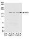 Uveal autoantigen with coiled-coil domains and ankyrin repeats antibody, NB100-61623, Novus Biologicals, Western Blot image 