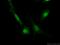 Minichromosome Maintenance Complex Component 7 antibody, 11225-1-AP, Proteintech Group, Immunofluorescence image 