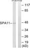 Serpin Family A Member 11 antibody, GTX87127, GeneTex, Western Blot image 