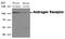 Androgen Receptor antibody, GTX50455, GeneTex, Western Blot image 