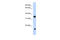 Glycerol-3-Phosphate Dehydrogenase 1 antibody, 25-748, ProSci, Western Blot image 