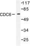Cell Division Cycle 6 antibody, LS-C175951, Lifespan Biosciences, Western Blot image 