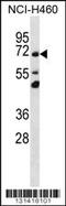 Transmembrane Protein 181 antibody, 56-403, ProSci, Western Blot image 