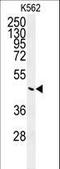 Glucose-6-Phosphatase Catalytic Subunit antibody, LS-C166302, Lifespan Biosciences, Western Blot image 