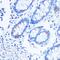 Leucine Rich Pentatricopeptide Repeat Containing antibody, GTX33302, GeneTex, Immunohistochemistry paraffin image 