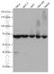 ArgRS antibody, 66815-1-Ig, Proteintech Group, Western Blot image 