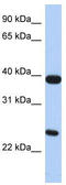 G Protein-Coupled Receptor 15 antibody, TA330386, Origene, Western Blot image 
