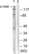 c-met antibody, abx012808, Abbexa, Western Blot image 