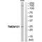 Transmembrane Protein 101 antibody, A17412, Boster Biological Technology, Western Blot image 