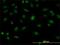 Splicing Factor Proline And Glutamine Rich antibody, H00006421-M02, Novus Biologicals, Immunocytochemistry image 