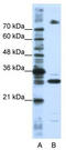 Serine And Arginine Rich Splicing Factor 10 antibody, TA343968, Origene, Western Blot image 