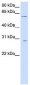 Patatin Like Phospholipase Domain Containing 4 antibody, TA346729, Origene, Western Blot image 