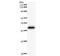 Zinc Finger Protein 384 antibody, LS-C342564, Lifespan Biosciences, Western Blot image 