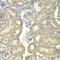 Acyl-CoA Synthetase Long Chain Family Member 5 antibody, 14-586, ProSci, Immunohistochemistry paraffin image 