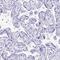 Gamma-Aminobutyric Acid Type A Receptor Alpha1 Subunit antibody, HPA055746, Atlas Antibodies, Immunohistochemistry frozen image 