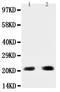 BCL2 Binding Component 3 antibody, PA1313, Boster Biological Technology, Western Blot image 