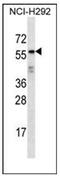 Outer Dense Fiber Of Sperm Tails 2 Like antibody, AP52988PU-N, Origene, Western Blot image 