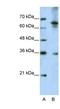 Wnt Family Member 9B antibody, NBP1-57937, Novus Biologicals, Western Blot image 