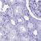Marginal Zone B And B1 Cell Specific Protein antibody, PA5-60493, Invitrogen Antibodies, Immunohistochemistry frozen image 