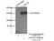 Collagen Type III Alpha 1 Chain antibody, 22734-1-AP, Proteintech Group, Immunoprecipitation image 