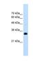 Ring Finger Protein 121 antibody, NBP1-59772, Novus Biologicals, Western Blot image 