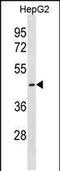 Cystinosin, Lysosomal Cystine Transporter antibody, PA5-49199, Invitrogen Antibodies, Western Blot image 