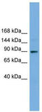 Tetratricopeptide Repeat Domain 27 antibody, TA344969, Origene, Western Blot image 