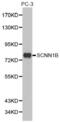 ENaC-Beta antibody, abx001464, Abbexa, Western Blot image 