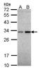 NAD(P)H Quinone Dehydrogenase 1 antibody, LS-C109515, Lifespan Biosciences, Western Blot image 