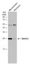 Synaptosome Associated Protein 23 antibody, GTX109089, GeneTex, Western Blot image 