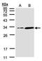 Phosphatidylinositol Transfer Protein Alpha antibody, PA5-21762, Invitrogen Antibodies, Western Blot image 