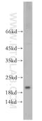 Eukaryotic Translation Initiation Factor 5A2 antibody, 17069-1-AP, Proteintech Group, Western Blot image 