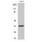 Annexin A3 antibody, LS-C382036, Lifespan Biosciences, Western Blot image 