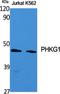 Phosphorylase Kinase Catalytic Subunit Gamma 1 antibody, A12257, Boster Biological Technology, Western Blot image 