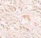 BTG3 Associated Nuclear Protein antibody, NBP1-76295, Novus Biologicals, Immunohistochemistry paraffin image 