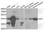 Adenosine Deaminase antibody, A1019, ABclonal Technology, Western Blot image 