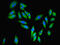 Poly(ADP-Ribose) Polymerase Family Member 3 antibody, LS-C376271, Lifespan Biosciences, Immunofluorescence image 